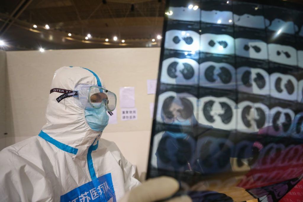 Một bác sĩ đang đọc hình chụp CT của một bệnh nhân COVID-19 ở Vũ Hán, Trung Quốc, ngày 5/3/2020. Ảnh: Barcroft Media via Getty Images.